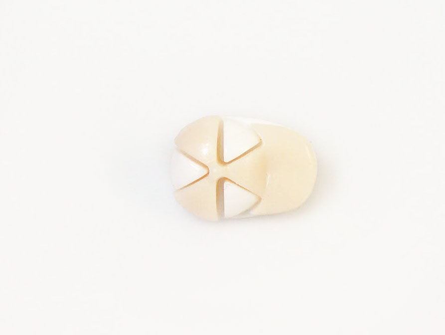 5 Cap Figure Buttons – Naalden – Accessoires – 1 st