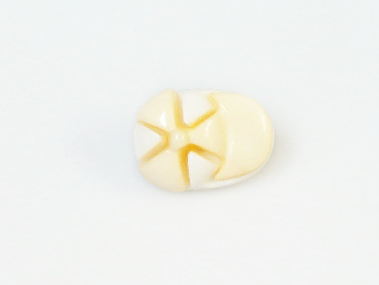 5 Cap Figure Buttons – Naalden – Accessoires – 1 st
